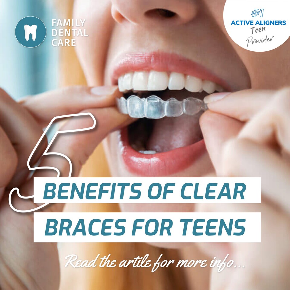 clear aligners clear braces hilton